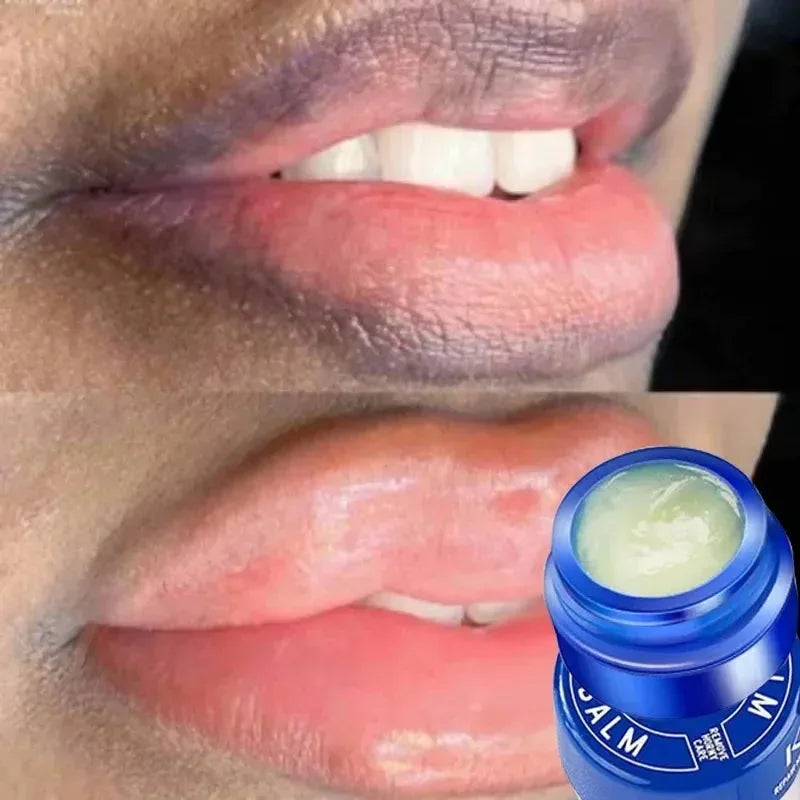 Bálsamo labial