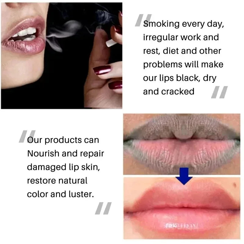 Bálsamo labial